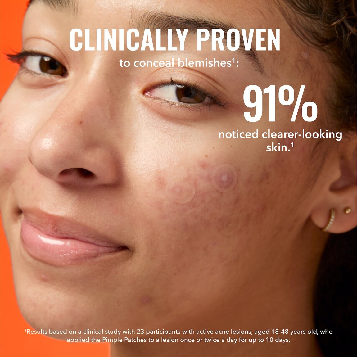 Pimple Patches E8