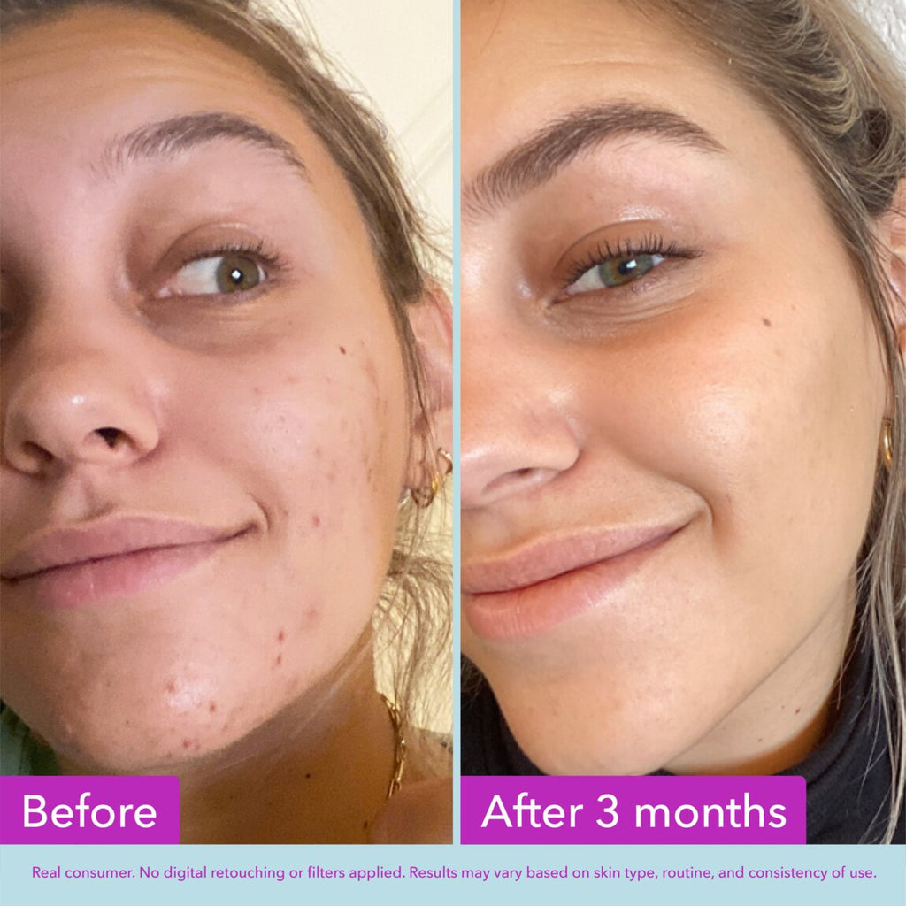 Niacinamide Brightening Toner G6