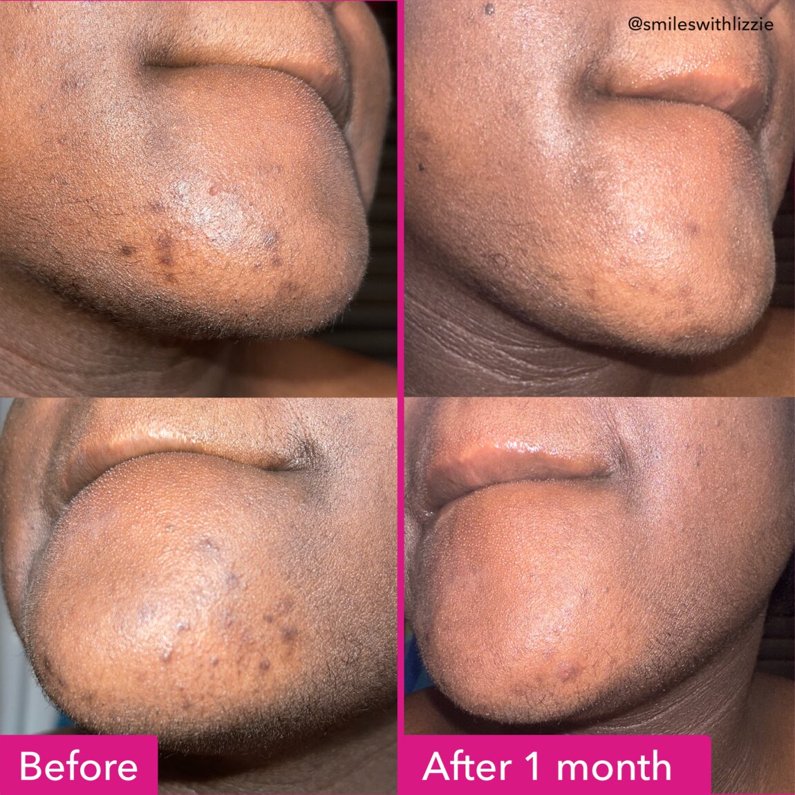 Brightening & Dark Spots Bar C8