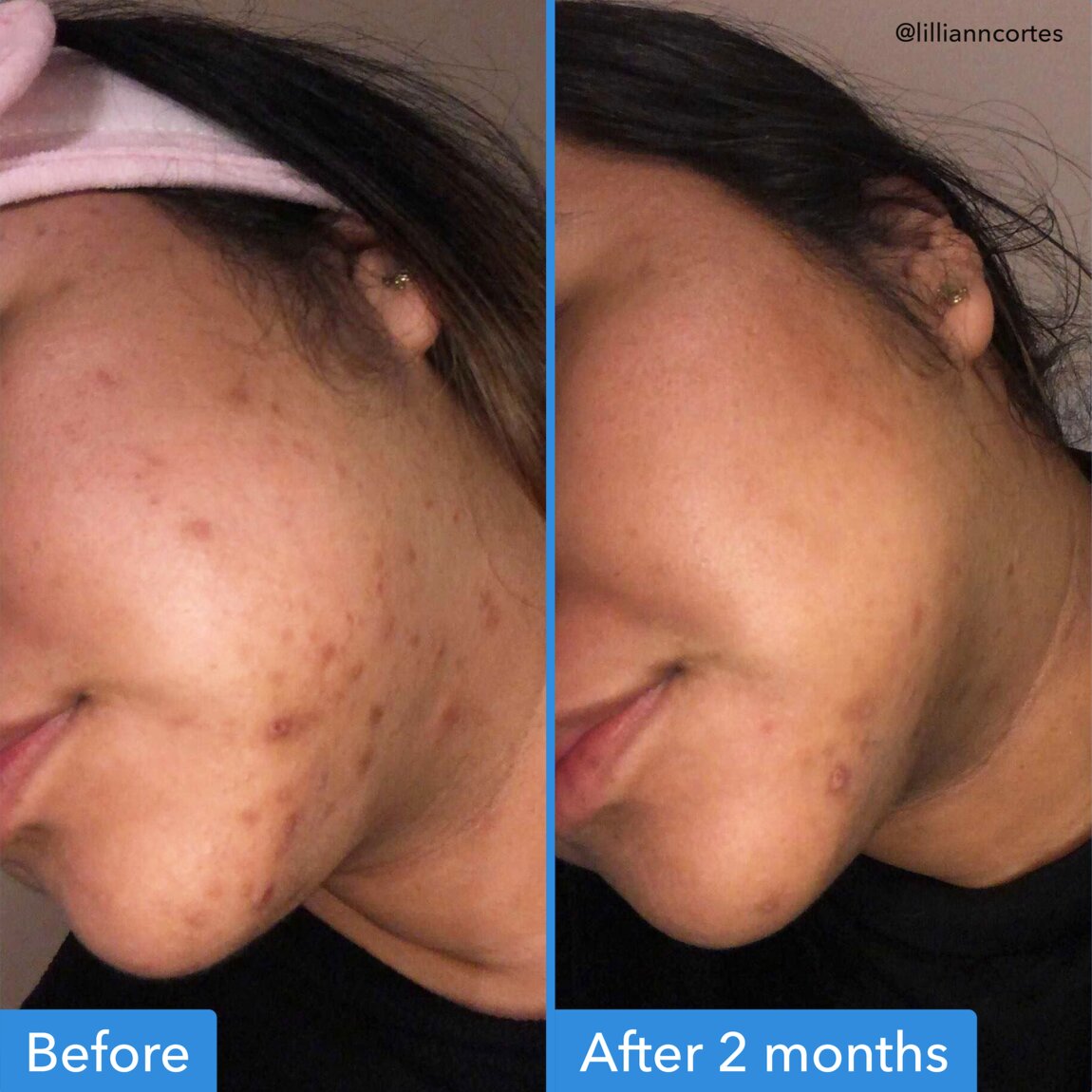 Discoloration Correcting Serum Q1