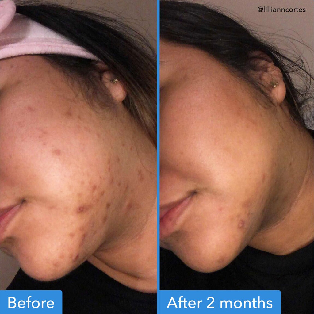 Discoloration Correcting Serum L9
