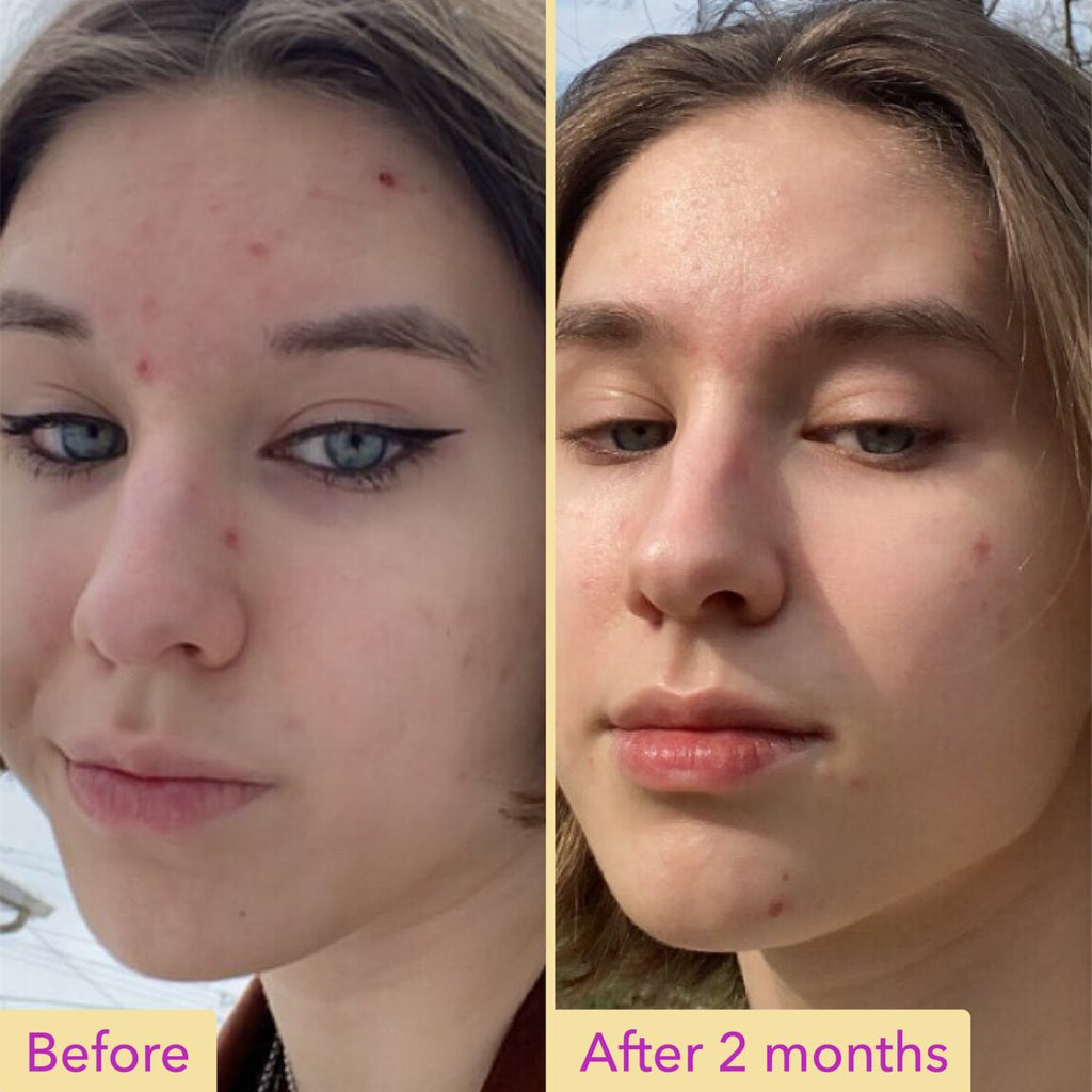 Niacinamide Serum R3